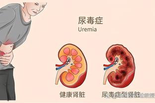 拉爵谈格林伍德：将了解事实而非炒作，根据价值观做出公平决定